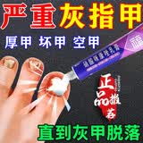 [福元]硝酸咪康唑乳膏 治疗灰指甲专用药最特新效药指甲增厚发黄变厚重度指甲手足真菌感染根药治皮肤用药 2%*15g 1盒装 【+盐酸特比萘芬喷雾剂】