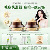 珂语苦参根祛痘膏草本植萃去痘痘和痘印痤疮炎痘青春专用痘坑面霜护肤 祛痘膏2瓶+洗脸巾
