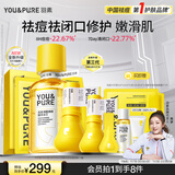 羽素祛痘大灯泡嫩肤套组 控油爽肤水去闭口祛痘面膜补水湿敷水