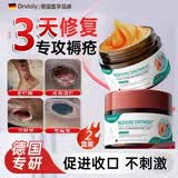 DRVIALY德国褥疮膏老烂腿伤口溃烂肤造口皮肤保护剂生肌膏褥疮姣特非药 2盒周期装【大面积溃烂流脓特效】