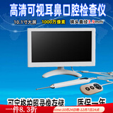 耳鼻喉电子内窥镜高清摄像可视采耳镜耳勺鼻炎口腔私密检查镜 新10寸屏（1000万）耳鼻喉通用