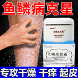 鱼鳞皮肤专用滋润保湿护肤小腿蛇皮肤纹路鸡皮肤防干燥脱皮身体乳 1瓶【专攻鱼鳞皮肤 】 官方正品