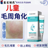 藤石制药儿童鸡皮肤毛周角化去除神器药脸部软化毛囊角化症脸上有小颗粒O6 单盒体验装 送棉签【鸡皮肤毛囊毛周角化症专用膏】