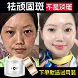 片仔癀皇后牌美白祛斑膏美白淡化黑色素老年黄褐雀斑晒斑祛斑霜护肤品女 专祛顽固斑50克*1瓶