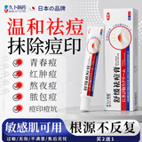 久卜制药祛痘药膏青春痘祛痘淡化痘印痘坑专用学生青少年 1盒