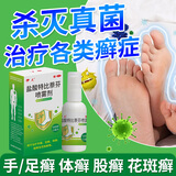 伊人 盐酸特比萘芬喷雾剂15ml:0.15g*15ml 用于治疗手癣足癣体癣股癣及花斑癣等