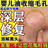 婴儿油收缩毛孔精华液去黑头深层清洁毛孔粉刺按摩保湿正品滋润油 100ml1瓶【婴儿椰子油】收缩毛孔