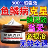 诸葛太医鱼鳞皮肤专用膏药去鱼鳞病蛇皮鸡皮肤霜全身腿部干燥脱屑身体乳 特效1盒【鱼鳞病克星】 鱼鳞皮肤霜去腿上鱼鳞皮