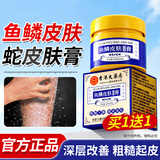 ADPWY鱼鳞皮肤专用可搭药膏腿干燥起皮鱼鳞皮肤霜止痒蛇皮腿去除神器