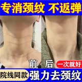 [臣功]维A酸乳膏 15克/支 2盒装 维A酸乳膏脖子去颈纹去除神器淡化颈纹去颈纹颈霜膏颈部去颈纹膏去提拉紧致祛斑祛皱纹 脖子长满纹 一抹验效