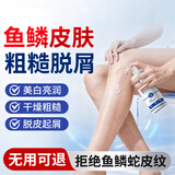 ADPWY鱼鳞皮肤身体乳腿干燥起皮鱼鳞皮肤霜小腿鱼鳞腿部专用搭药膏润肤
