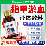 DR.AVIN指甲淤血液体敷料手指甲脚趾甲床受伤发黑黑指甲发紫修复液专用NH 2盒实惠装【代文医用液体敷料】第二盒半价