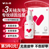 涩冈制薬甲沟炎消肿专用灰指甲真菌感染脱甲坏甲红肿发炎流脓嵌甲矫正器