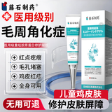 藤石制药儿童鸡皮肤毛周角化去除神器药脸部软化毛囊角化症脸上有小颗粒O6 买2送1 送棉签【疗程装】疗程下单 无用可退专用