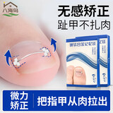 八海鸟甲沟炎矫正器贴片脚趾甲往肉里长专用正甲贴嵌甲脚指甲纠正神器