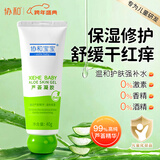 协和芦荟凝胶40g宝宝儿童库拉索晒后修护舒缓控油补水蚊虫叮咬痘肌