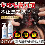 同仁堂毛发囊炎洗发水男女士去屑止痒控油持久蓬松脂溢性金榜第1名500ml