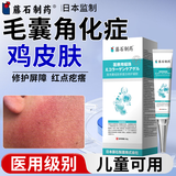 藤石制药儿童鸡皮肤毛周角化去除神器药脸部软化毛囊角化症脸上有小颗粒O6 第二盒半价 送棉签【鸡皮肤疙瘩毛囊角化】轻度专用
