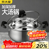 炊大皇 汤锅304不锈钢加厚20cm小奶锅煮面无涂层炖汤锅燃气灶电磁炉通用
