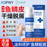ADPWY鱼鳞皮肤专用可搭药膏小腿干燥起皮鱼鳞皮肤霜腿部蛇皮腿去除神器