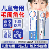 ADPWY儿童脸上小颗粒小疙瘩鸡皮肤去除神器毛周角化专用可搭药膏青少年