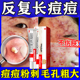 [花容美]阿达帕林凝胶 0.1%*10g 1盒装 改善毛孔粗大去黑头医用祛痘消炎痤疮硬疙瘩脸上长痘痘专用药粉刺痘印修复粉刺