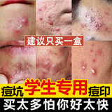 同仁堂学生祛痘药膏去痘痘和痘印青春痘坑淡化痘印青少年痤疮男女20g