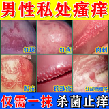 [华青]克霉唑乳膏 10g 5盒装 龟头瘙痒炎真菌感染京大东大药房龟头红肿红点瘙痒抗霉菌白垢豆腐渣私处男士皮肤专用药 巩固装 一次买对
