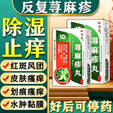 [吉华舒]荨麻疹丸 荨麻疹专用药 皮肤过敏瘙痒止痒断药根增强发货免疫力过敏药中药调理止痒【视觉特效】 10g*9袋 1盒装 【国药正品】