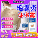 藤石制药马拉色菌毛囊炎沐浴露后背部背上长痘痘男可搭私处专用喷雾剂GU 沐浴露单盒【体验装】 【日本藤石】医用湿性修复功能敷料