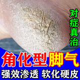 [金归]环吡酮胺乳膏 治疗角化型干裂脚气药脚后跟真菌感染干裂脱皮专用药脚脱皮脚后跟脚干裂膏特新效药  1盒装 【脚后跟干硬】