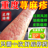 [吉华舒]荨麻疹丸 荨麻疹专用药 皮肤过敏瘙痒止痒断药根增强发货免疫力过敏药中药调理止痒【视觉特效】 10g*9袋 3盒装 【大多数人的选择】