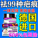 福隆藤原去疤痕药膏增生凸起祛除疙瘩医院用止痒修复凝胶儿童专用德国进口 1盒【德国进口】 新旧疤痕灵贴手术缝针烫伤痒日本
