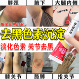 [良福制药]维A酸乳膏 治疗角化异常引起去黑色素沉淀去除脖子腋下私处大腿内侧屁股黑淡化黑色素面部医用 0.1%*15g 1盒装 【软化角质 淡化色素】