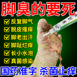 [科田]华佗膏 10g 1支装 脚臭脚气专用药[主图视觉特效]治疗严重脚气药止痒脱皮烂脚丫真菌感染趾根处治脚出汗 治疗脚气