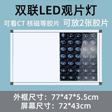 天霖医用LED观片灯箱可调亮度带桌架院线门诊x光片看片灯单联双联观片 LED双联观片灯