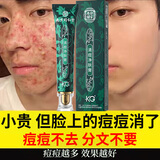同仁堂祛痘膏去痘痘和痘印痘坑修复男女士改善粉刺闭口30g