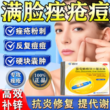 [纽兰]葡萄糖酸锌口服溶液 10ml:35mg*10支 3盒装 成年人祛痘消炎重度面部痤疮专用内服药青少年硬疙瘩祛痘口服液葡萄糖酸锌女士 痤疮内服药