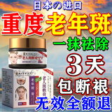 肤研祛斑霜去老年斑专用特效非药一夜消黄褐斑雀斑晒斑女男士医用的药 特效一盒【一夜消】日本进口 强力祛除手部脸部淡化黑色素纯中药正品进口