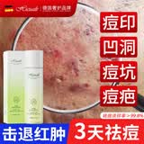 HIEUAILR水杨酸祛痘搭药膏祛痘淡化痘印修复消除痘坑凹洞消炎痤疮专用精华 一盒体验装【专攻痘印】 100ml