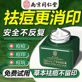 同仁堂祛痘膏去痘痘和痘坑修护初高中生男女学生粉刺青春痘20g七夕