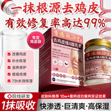 香港敬沛堂鸡皮肤疙瘩毛周角化症专用去除大腿胳膊手臂疙瘩去角质维A酸乳膏