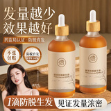 儒意育头发液固发脂溢防脱育发营养增长液发际线生长液长发剂头皮精华 【医研配方】防脱育发 100ml*1瓶