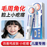 薪琦茗儿童脸上小疙瘩用的鸡皮肤去除神器毛周角化专用可搭药膏脸部20g
