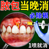 广雅千方百剂牙龈脓包肿痛鼓包化脓儿童智齿牙根发炎上火肿包流脓消炎专用喷剂 一盒特效装【牙龈脓包专用】