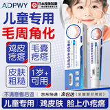 ADPWY儿童脸上小颗粒小疙瘩鸡皮肤去除神器毛周角化专用可搭药膏青少年