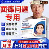 正虎堂 面瘫贴后遗症专用贴 口眼歪斜面部抽蓄面肌痉挛穴位贴