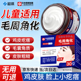 韶琪儿童脸上小疙瘩用的鸡皮肤去除神器毛周角化专用可搭药膏脸部30g