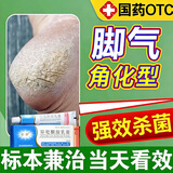 [金归]环吡酮胺乳膏 环吡酮胺乳膏治疗真菌感染脚气抗菌 角化型干裂脚气药皮肤用药 1%*20g 1盒装 【化型脚气脚底皮厚开裂】
