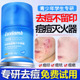 五羊（FIVERAMS）青少年控油祛痘修护面霜12-18岁男女孩初高中学生青春期护肤品50g